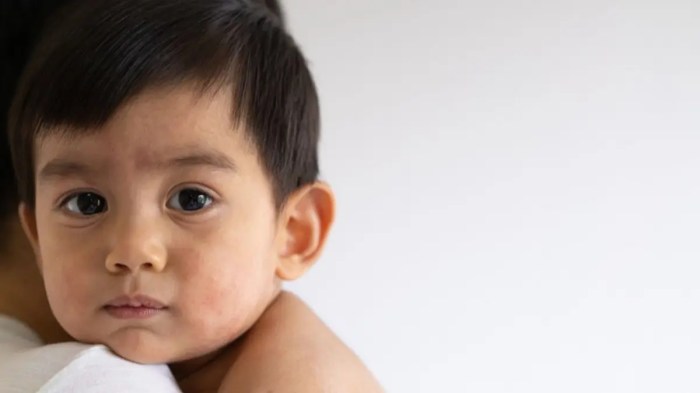 Asupan nutrisi adalah