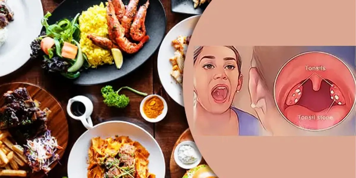 Pantangan Makanan Radang Amandel Anak dan Dewasa - Lasehatin